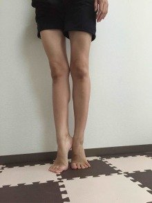 足痩せ・トレーニング（東京）